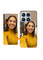 Coque Xiaomi 17 personnalisée