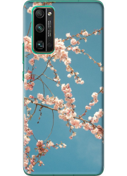 Coque personnalisée Honor 30 Pro