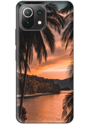 Coque Xiaomi Mi 11 Lite personnalisée