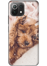 Coque 360° Xiaomi Mi 11 Lite  personnalisée