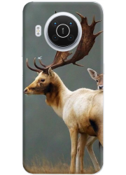 Coque 360° Nokia X20 personnalisée