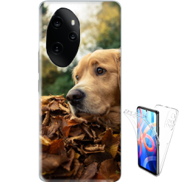 Coque 360&deg; double face Honor 100 Pro personnalis&eacute;e
