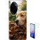 Coque 360° double face Honor 100 Pro personnalisée 