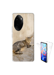 Coque 360° double face Honor 100 personnalisée 