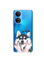 Coque Honor X7 personnalisée